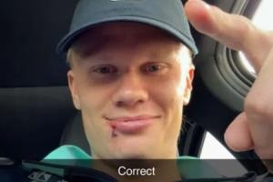 下巴缝3针！哈兰德与球迷互动确认：被厄德高打到的，没错。