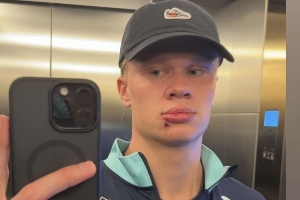 【小吧社交秀】内维斯女友青春甜美 哈兰德帅脸意外“破相”